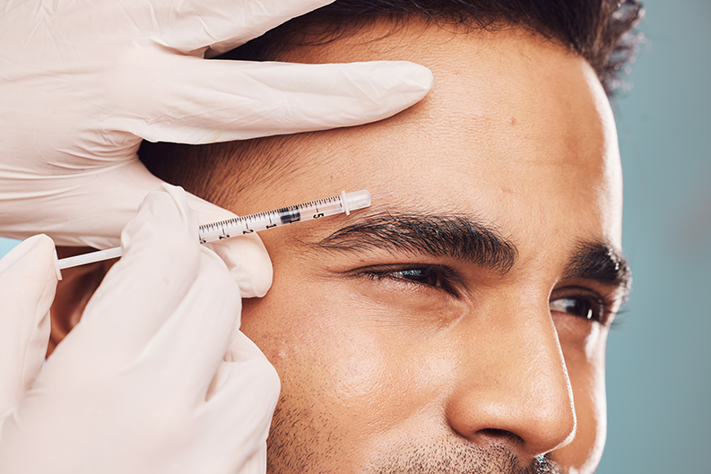Brow Lift