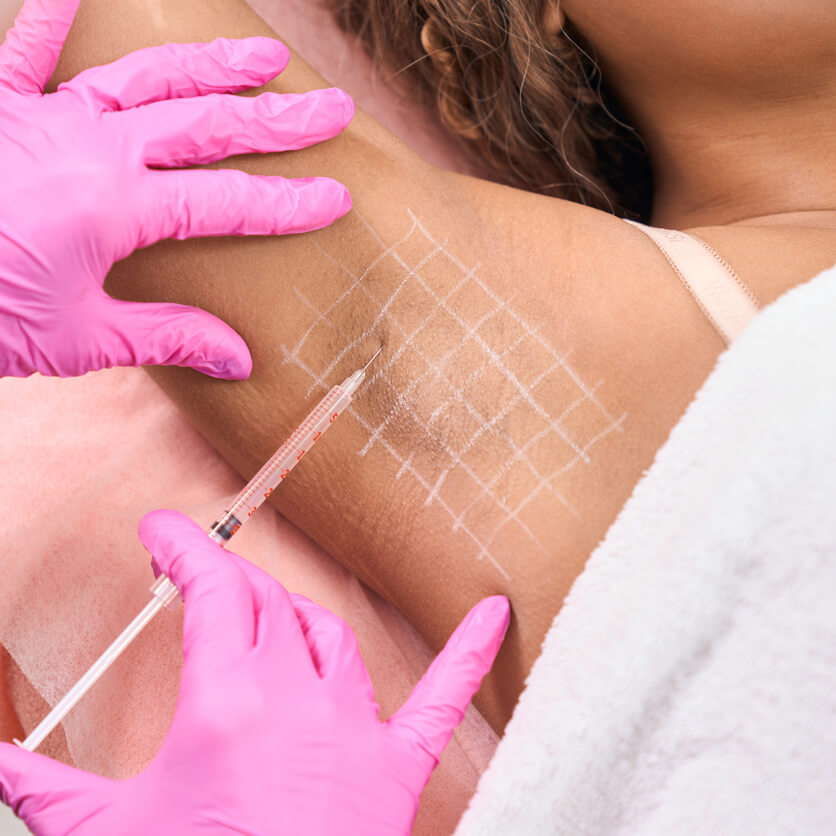 Hyperhidrosis (Underarms)